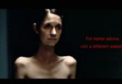 About Anorexia